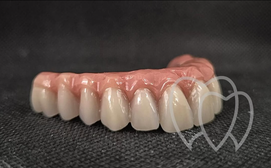 Carga imediata produzida pela FixSmile